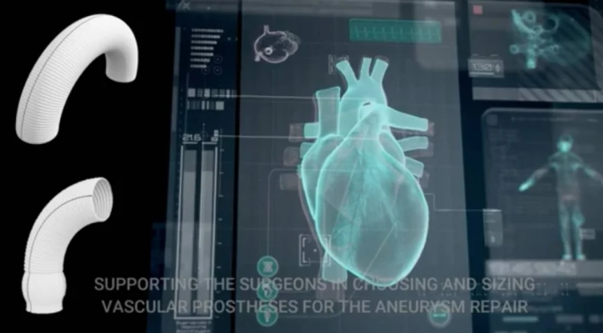 Aneurismi aortici: il progetto europeo Pandora rivoluziona la chirurgia con la modellazione in-silico