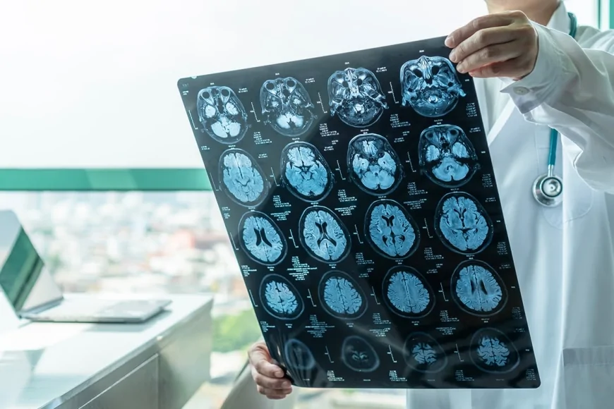 Neurologia: l’intelligenza naturale resta superiore all’intelligenza artificiale