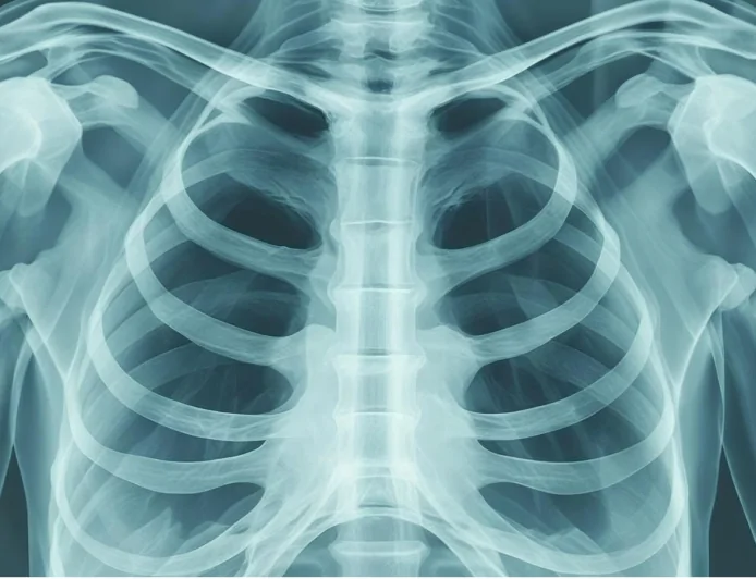 Fibrosi cistica, la “seconda identità” del farmaco Ivacaftor apre nuove prospettive di cura