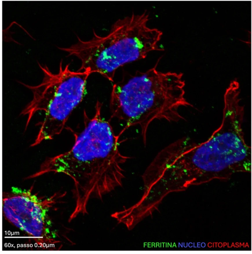 Tumore pediatrico del cervelletto: una molecola di RNA regola la sopravvivenza  delle cellule di medulloblastoma