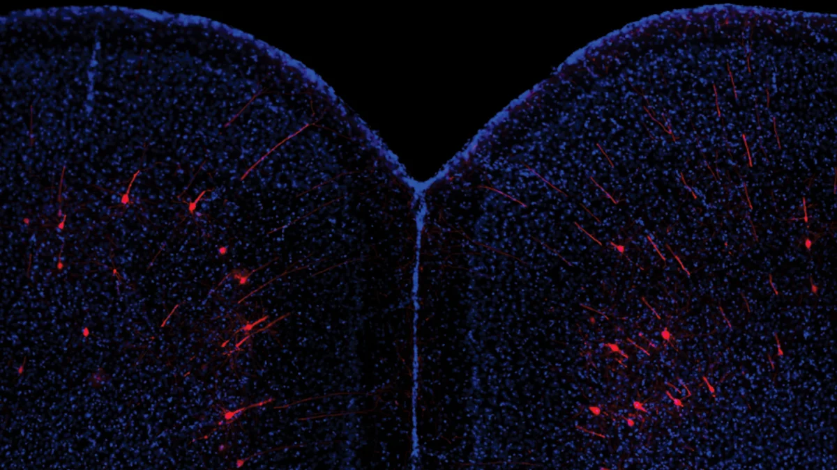 Neuroscienza: scoperto un meccanismo che permette al cervello di calibrare le risposte comportamentali in base al contesto