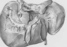 Malattie autoimmuni del fegato: definiti per la prima volta i criteri condivisi per riconoscere e trattare la sindrome variante PBC-AIH