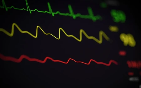 Fibrillazione atriale: la sola terapia anticoagulante potrebbe non essere sufficiente a ridurre il rischio di declino cognitivo