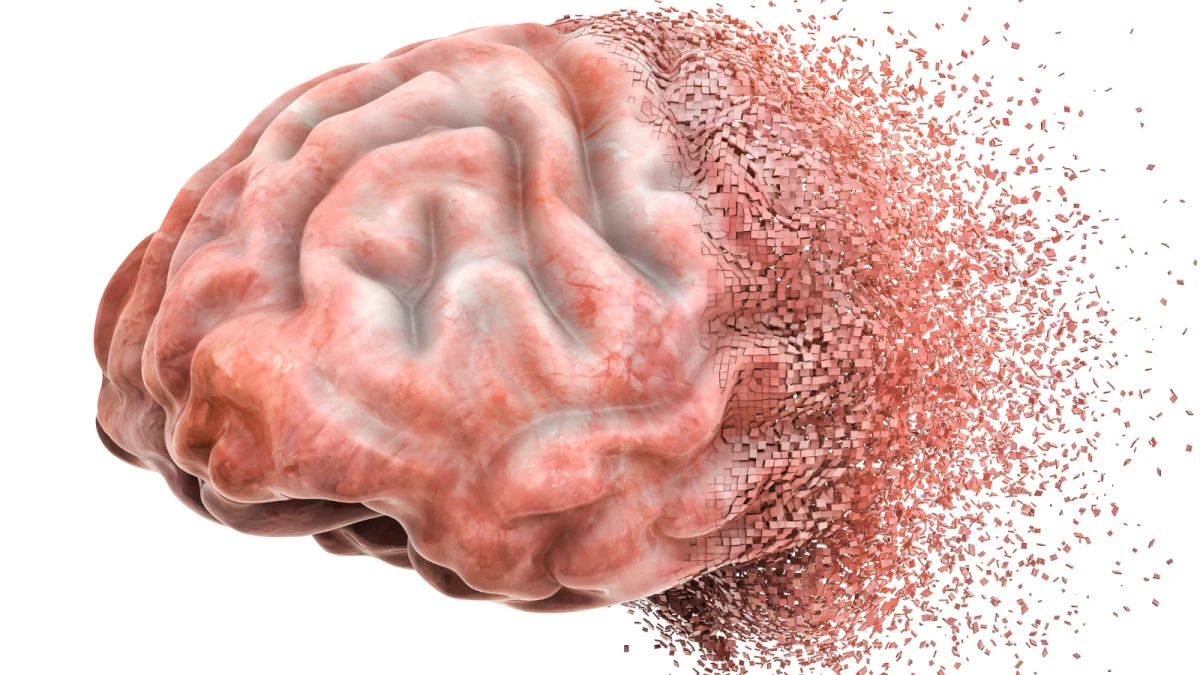 Malattie Neurodegenerative: il ruolo cruciale dell’intestino