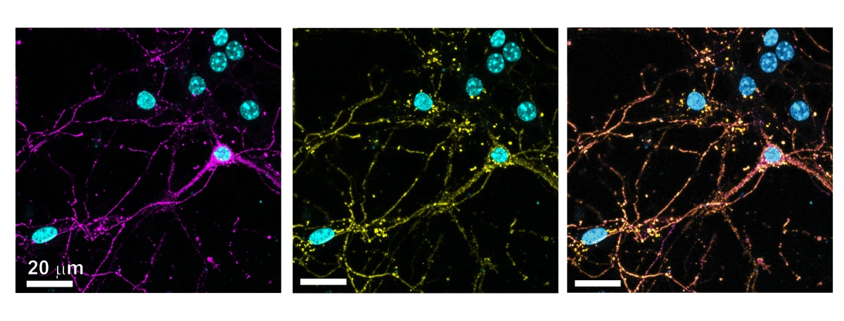 Neuroscienze ed Oncologia: l'utilizzo di batteriofagi come vettori bio-ispirati per trasportare farmaci al cervello 