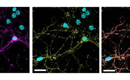 Neuroscienze ed Oncologia: l'utilizzo di batteriofagi come vettori bio-ispirati per trasportare farmaci al cervello 