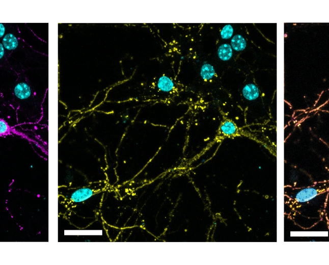 Neuroscienze ed Oncologia: l'utilizzo di batteriofagi come vettori bio-ispirati per trasportare farmaci al cervello 